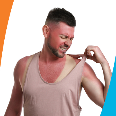 Person who is sunburned and holding the strap of their shirt